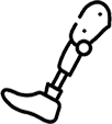 Carbon Fiber Prosthesis
